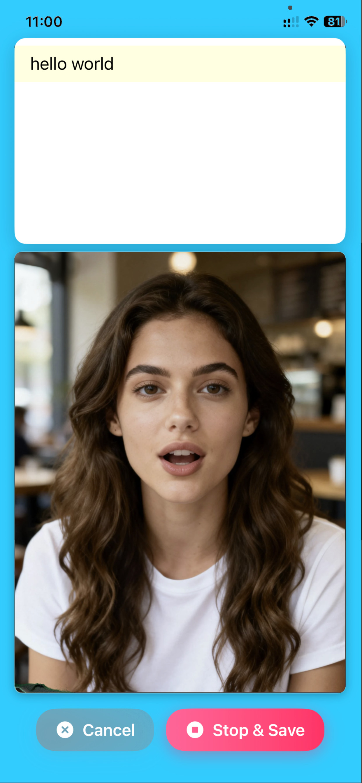 MyAIPrompter Settings Interface